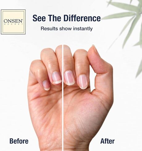 Onsen Secret Cuticle Cream + Double Sided Nail File 120/180 Grit, Cuticle Oil - Japanese Natural Healing Minerals Nail Care Serum. Sooth, Repair, & Strengthen Cuticles & Nails, Non-Greasy – 30ml in Saudi Arabia