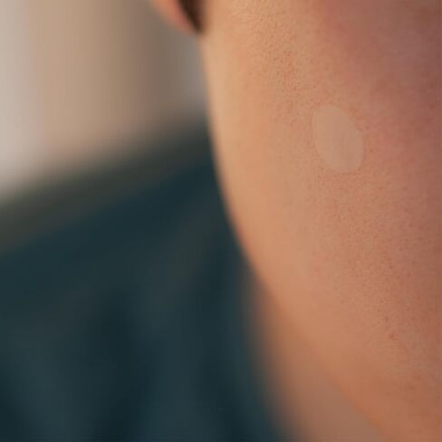 SMARTMED Cover Dot Acne Care (120 نقطة) علاج عيوب البشرة باستخدام الغروانية المائية | يمتص الزيوت والبثور، وخالي من اللاتكس in Saudi Arabia