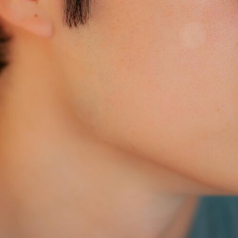 SMARTMED Cover Dot Acne Care (120 نقطة) علاج عيوب البشرة باستخدام الغروانية المائية | يمتص الزيوت والبثور، وخالي من اللاتكس in Saudi Arabia
