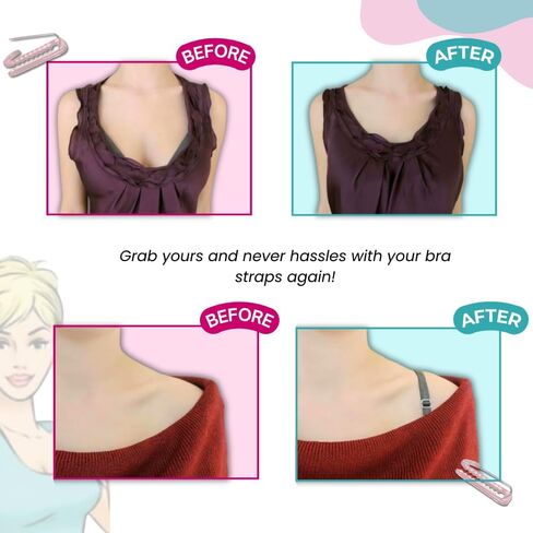 3 Pack Bra Strap Holder - Bra Strap Clip - Bra Clips For Straps - Straps With Clips For Bra Straps - Bra Holder - Clothing Clips - Bra Clip - Bra Lifters For Women - Noel & Co. in Saudi Arabia