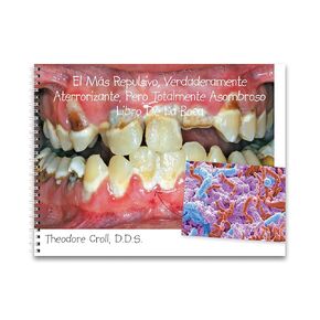 Practicon 8010837 Grossest Truly Terrifying But Utterly Awesome Mouth Book, Spanish Translation