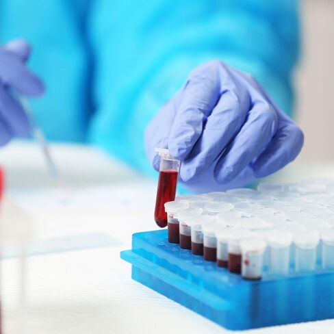 صناديق تجميد من البولي كربونات 81 بئر من باتيكل، قطعتان من حامل أنبوبي من البولي كربونات لعينات قوارير أنابيب سعة 2.0 مل، أصفر in Saudi Arabia