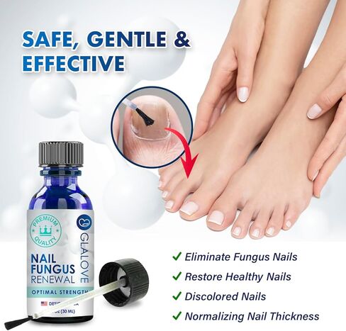 Toenail Fungus Treatment At Home: Nail Fungus Treatment Extra Strength Fast Acting One Week - Safely Repair Renew Damaged And Discolored Toenails - Effectively Improve Athlete's Nail Health in Kuwait
