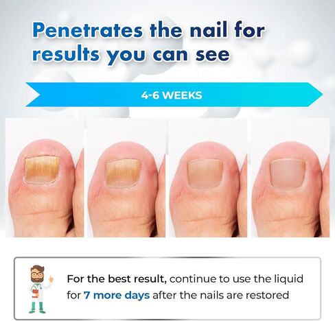 Toenail Fungus Treatment At Home: Nail Fungus Treatment Extra Strength Fast Acting One Week - Safely Repair Renew Damaged And Discolored Toenails - Effectively Improve Athlete's Nail Health in Kuwait