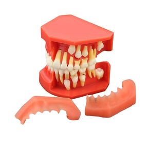 Teeth Eruption Development Model Teaching Education Model #4007