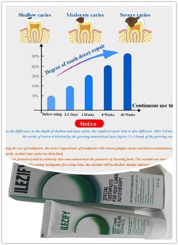 Nanohydroxyapatite Toothpaste Instead of Root Canal Therapy & Relieve Pain of Pulpitis, Hydroxyapatite Toothpaste for Gum Care Prevent Teeth Root Fracture, 3.52Oz for Adults Mint Flavor in Saudi Arabia