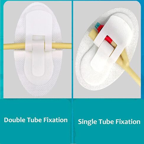 2pcs Catheter Fixing Device,Catheter Fixation Tape Fixation Strap, Fixation Strap in Kuwait