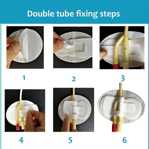 2pcs Catheter Fixing Device,Catheter Fixation Tape Fixation Strap, Fixation Strap in Kuwait