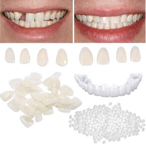 Tooth Repair Kit for Fixing the Missing Chipped and Broken Tooth Gap Temporary Replacement Thermal Beads and Fake Teeth Brace Mold