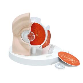 3B Scientific F17 Pathological Eye Enlarged 5 Times - 3B Smart Anatomy
