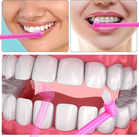 مجموعة من 6 فرش معنقدة من سيبا، فرشاة أسنان ناعمة واحدة ذات دعامة لتقويم الأسنان، فرشاة أسنان مدببة طرفية، فرشاة أسنان مدمجة بين الأسنان لتنظيف التفاصيل in Saudi Arabia