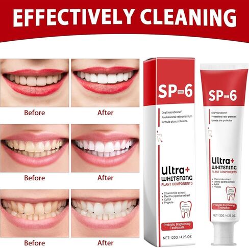 معجون أسنان للتبييض الفائق Sp-6، معجون أسنان للتبييض بالبروبيوتيك Sp-6، معجون أسنان Sp 6، معجون أسنان للعناية بالتنظيف العميق، نفس منعش 120 جم (قطعة واحدة) in Kuwait