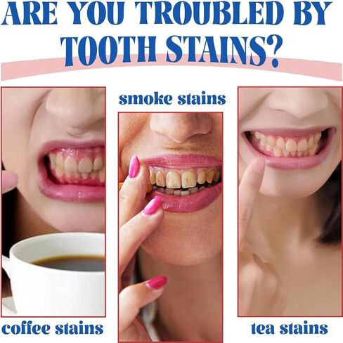 معجون أسنان للتبييض الفائق Sp-6، معجون أسنان للتبييض بالبروبيوتيك Sp-6، معجون أسنان Sp 6، معجون أسنان للعناية بالتنظيف العميق، نفس منعش 120 جم (قطعة واحدة) in Kuwait