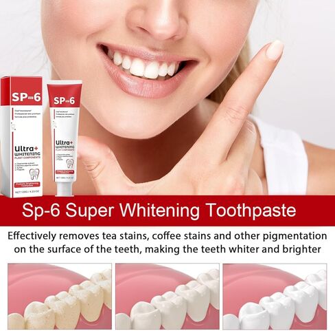 معجون أسنان للتبييض الفائق Sp-6، معجون أسنان للتبييض بالبروبيوتيك Sp-6، معجون أسنان Sp 6، معجون أسنان للعناية بالتنظيف العميق، نفس منعش 120 جم (قطعة واحدة) in Kuwait