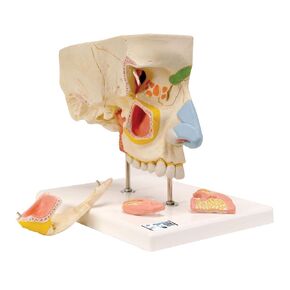 3B Scientific E20 Nose with Paranasal Sinuses 5-Part - 3B Smart Anatomy