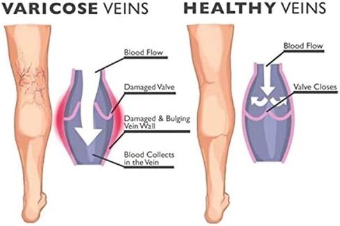 جوارب ضغط من PACKO SOCKS للنساء والرجال - للطب والتمريض والمشي لمسافات طويلة والتعافي والسفر والطيران (أسود، S/M) in Kuwait