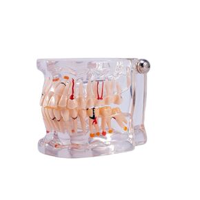 Dental Pathology Model Transparent Standard Teaching Model for Dentist Teaching