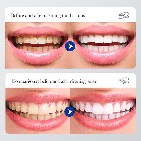 BIOAQUA 1.5X Instant Whitening Toothpaste Balance Oral Flora Whiten Gingival Protection Fresh Breath Enamel Safe 100g / 3.38oz (Descal Stain Removal (Hyaluronic Acid)) in Saudi Arabia