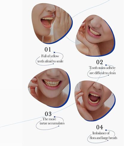BIOAQUA 1.5X Instant Whitening Toothpaste Balance Oral Flora Whiten Gingival Protection Fresh Breath Enamel Safe 100g / 3.38oz (Descal Stain Removal (Hyaluronic Acid)) in Saudi Arabia