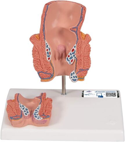 3B Scientific K27 Hemorrhoid Model - 3B Smart Anatomy in Kuwait