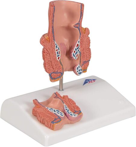3B Scientific K27 Hemorrhoid Model - 3B Smart Anatomy in Kuwait