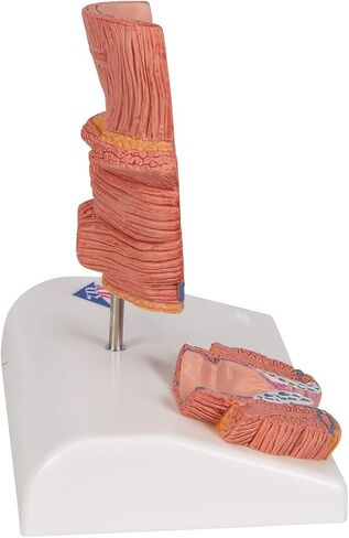 3B Scientific K27 Hemorrhoid Model - 3B Smart Anatomy in Kuwait