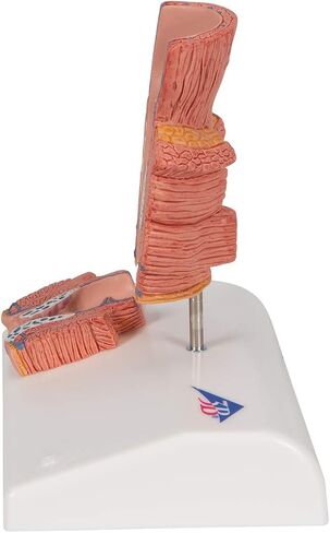 3B Scientific K27 Hemorrhoid Model - 3B Smart Anatomy in Kuwait