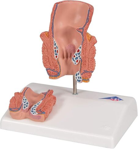 3B Scientific K27 Hemorrhoid Model - 3B Smart Anatomy in Kuwait