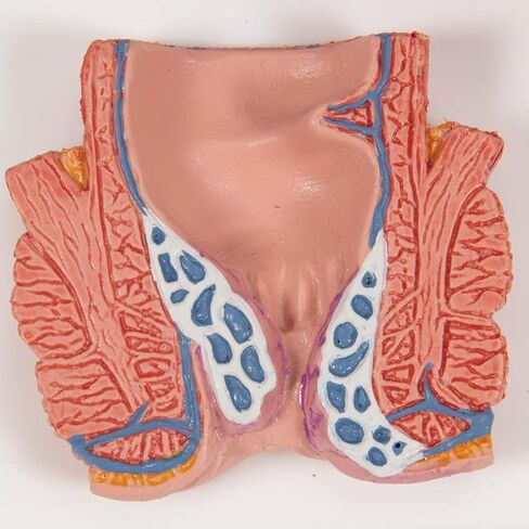 3B Scientific K27 Hemorrhoid Model - 3B Smart Anatomy in Kuwait