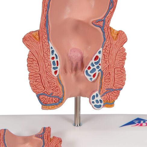 3B Scientific K27 Hemorrhoid Model - 3B Smart Anatomy in Kuwait