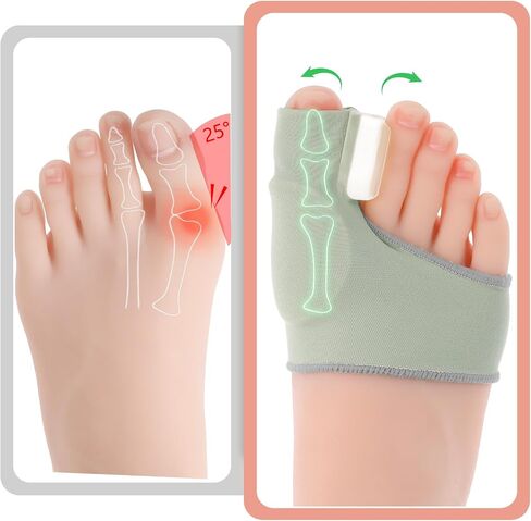 Sibba Bunion Splints Corrector Big Overlapping Toe Straightener Relief Fix Splint Socks Brace Spacers Remover Bunions Sandals Straighteners Comfort Foot Cushions For Women Men in Saudi Arabia