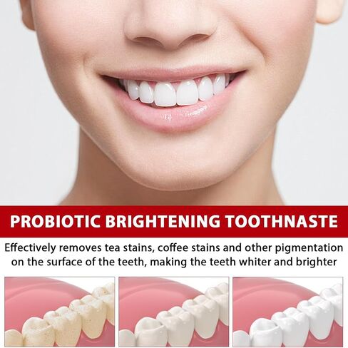 Sp-6 Ultra Whitening Toothpaste, Upgrade - 2PCS Sp6 Probiotic Brightening Toothpaste, Fresh Breath, Deep Cleaning & Care 120g in Saudi Arabia