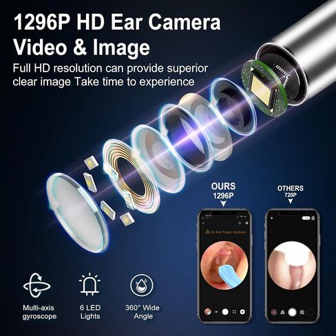 Ear Wax Removal, Earwax Remover Tool with 8 Pcs Ear Set, Ear Cleaner with Camera, Earwax Removal Kit with Light, Ear Cleaner for iOS & Android, Black (Black, Standard) in Saudi Arabia