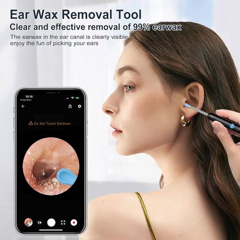 Ear Wax Removal, Earwax Remover Tool with 8 Pcs Ear Set, Ear Cleaner with Camera, Earwax Removal Kit with Light, Ear Cleaner for iOS & Android, Black (Black, Standard) in Saudi Arabia