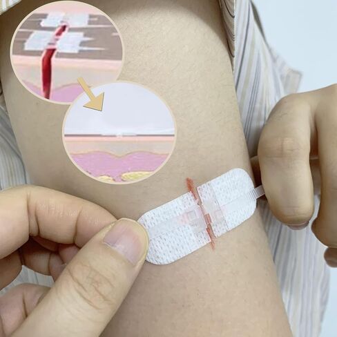 Emergency Wound Closures Adhesive Bandages, Zip Stitch Stickers for Camping, Survival & Household Gear, 3 Pcs (70 * 22mm, White) in Saudi Arabia