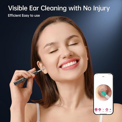 مجموعة إزالة شمع الأذن مع كاميرا 1296 بكسل، أداة إزالة شمع الأذن، مجموعة تنظيف الأذن، منظف الأذن مع كاميرا، منظار الأذن مع ضوء لهواتف iPhone وiPad وهواتف Android (أبيض) in Kuwait