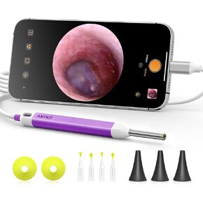 Anykit Digital Otoscope with Gyroscope, HD Ultra Clear View Ear Camera with Ear Wax Removal Tools, Video Ear Scope Otoscope with Light, Compatible with Android, iPhone 15 (Silver)