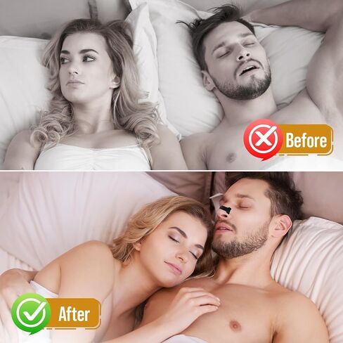 Nasal Strips for Snoring - Nose Strips for Breathing - Anti Snoring Solution & Nasal Congestion Relief Nose Tape for Sleeping - Black, Universal Fit, Extra Strength for Sensitive Skin in Saudi Arabia