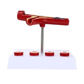 Atherosclerosis Medical Model Human Atherosclerosis Cardiovascular Blood Model Vessel Anatomical Model Teaching Supplies Atherosclerosis Model Blood Vessel Anatomical Model