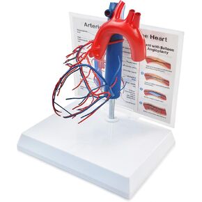NEW HORIZON Human Heart Model Vascular Heart, Naturally Size, with base Increased sized coronary anatomy depicting the cardiac veins