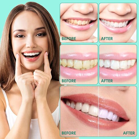 Coconut Pulling Oil for Teeth Whitening(4.2 Fl.Oz),Mouthwash Mint Oil Pulling with Tongue Scraper,Natural Coconut & Peppermint Oil Mouthwash,Supports Healthy Gums,Dye Free,Fresh Breath in Kuwait
