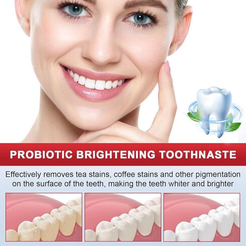 معجون أسنان بروبيوتيك Sp 8، معجون أسنان بروبيوتيك Sp 8 لتفتيح الأسنان، معجون أسنان Sp 8 Ultra مع فرشتي أسنان، معجون أسنان Sp 8 نفس منعش، معجون أسنان تبييض التنظيف العميق (قطعتان) in Kuwait