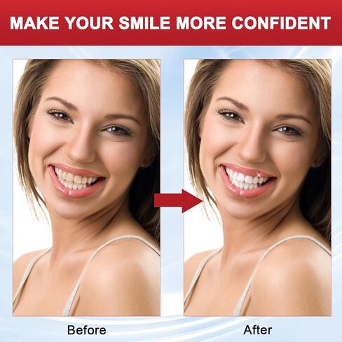 معجون أسنان بروبيوتيك Sp 8، معجون أسنان بروبيوتيك Sp 8 لتفتيح الأسنان، معجون أسنان Sp 8 Ultra مع فرشتي أسنان، معجون أسنان Sp 8 نفس منعش، معجون أسنان تبييض التنظيف العميق (قطعتان) in Kuwait