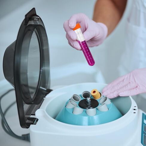 PATIKIL 20ML Plastic Centrifuge Tubes, 40 Pcs Round Bottom Centrifuge Tube with Screw Caps and Graduated Marks Write-on Spot for Laboratory Liquid, Clear in Saudi Arabia