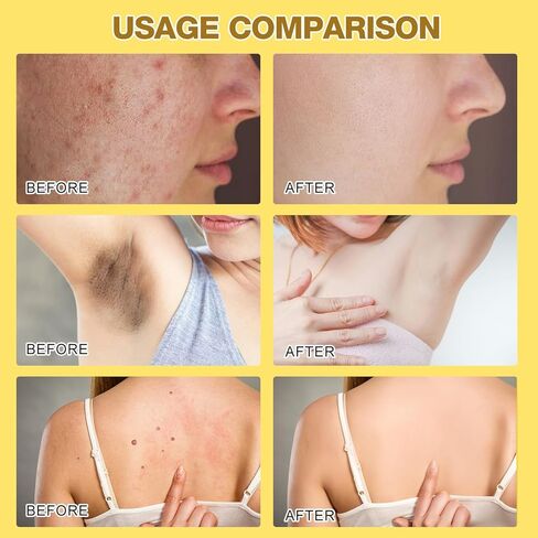 قطعتان من كريم معالجة سم النحل، جل معالجة سم النحل، كريم سم النحل، كريم إصلاح سم النحل الاحترافي لجميع أنواع البشرة in Kuwait