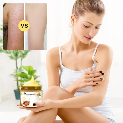 قطعتان من كريم معالجة سم النحل، جل معالجة سم النحل، كريم سم النحل، كريم إصلاح سم النحل الاحترافي لجميع أنواع البشرة in Kuwait