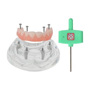 Dental Typodont Implant Restoration Modle All On 4 Overdenture Model Upper Mandible Type Demo Practice Teeth Model with 4 Implants Nails M6001-1