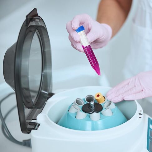 أنابيب طرد مركزي بلاستيكية 50 مل من باتيكل، حاوية أنبوب اختبار مخروطية 12 قطعة مع أغطية لولبية مانعة للتسرب وعلامات متدرجة لسائل المختبر، برتقالي in Saudi Arabia