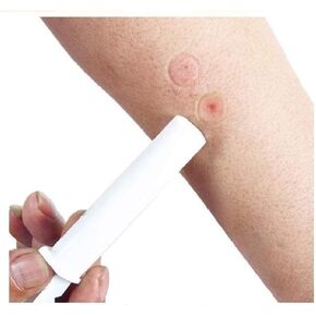 2PK Mosquito Bee Sting Bug Bite Kit Suction Tool Safety First Aid Supplies Tool Natural Sting First Aid for Hiking Backpacking Camping