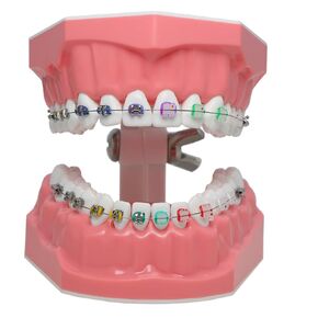 Dental Typodonts Teeth Model Orthodontics Demonstration with Metal Wires Clear Braces Teaching Learning Model for Clinical Education Tool